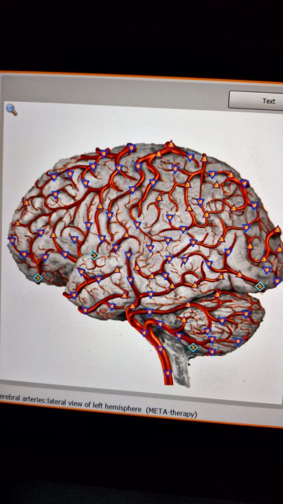 left hemisphere of the brain