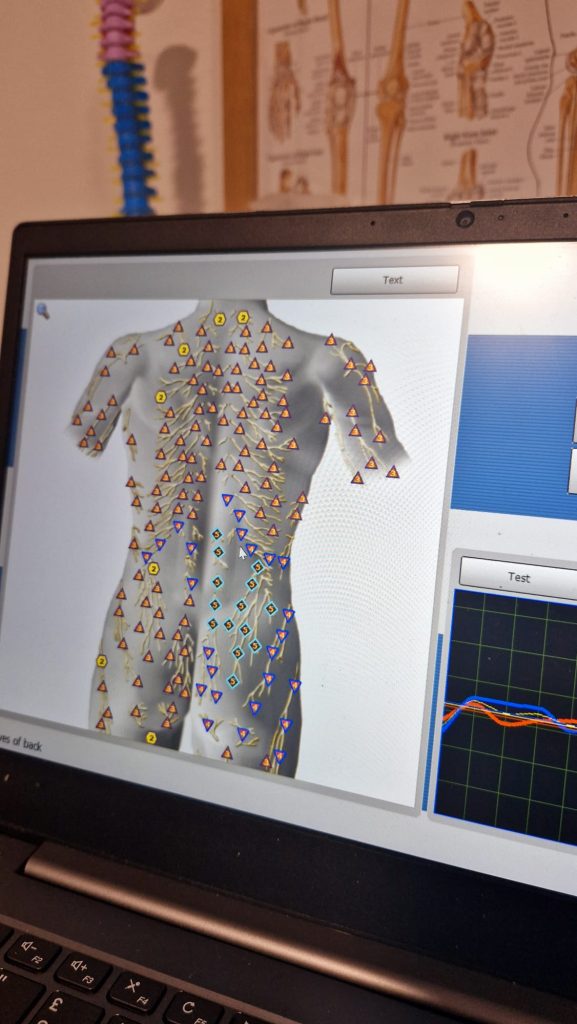 Bioresonance scan of nerves in back